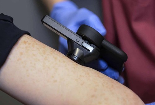 Digital Dermatology Innovation